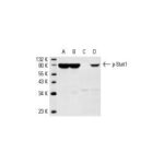 Marcador Hrp (Horseradish Peroxidase) Fr/100Mg