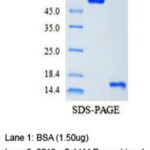 Proteina Recombinante Covid-19 (Sars-Cov-2 M) - Fr/0,1Mg