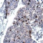 Cyclin A2 Antibody [Gt2547]  100Ul