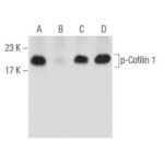 Coquetel Inibidor De Fosfatase B - 1Un