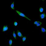 ANTICORPO ANTI-P GLYCOPROTEIN/ABCB1 IGG POLICLONAL COELHO-100UG