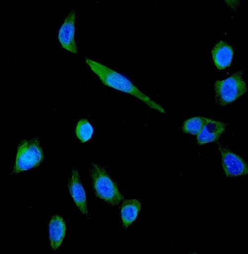 ANTICORPO ANTI-P GLYCOPROTEIN/ABCB1 IGG POLICLONAL COELHO-100UG