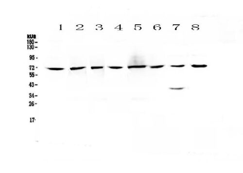 ANTICORPO CHRNA4 POLICLONAL IGG- COELHO - FR/100UG