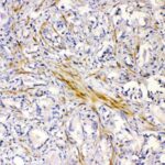 ANTICORPO CHRNA5 POLICLONAL IGG COELHO - FR/100UG