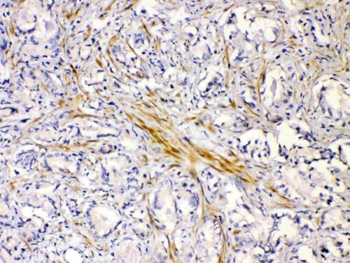 ANTICORPO CHRNA5 POLICLONAL IGG COELHO - FR/100UG