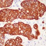 ANTICORPO ANTI-CYTOKERATINA 5 (C-TERM) KRT5