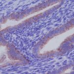 ANTICORPO ANTI-CYTOKERATIN 7 KRT7