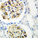 ANTICORPO CD34 COELHO POLICLONAL IGG - FR/100UG