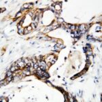 ANTICORPO ANTI-UPA RECEPTOR/PLAUR IGG POLICLONAL COELHO -100UG