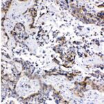 ANTICORPO ANTI-MRP1/ABCC1 IGG POLICLONAL COELHO -100UG