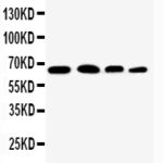 ANTI-NF-KB P65 / RELA