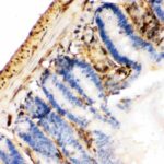 ANTICORPO ANTI-GALECTIN 1/LGALS1 POLICLONAL IGG COELHO - 100UG