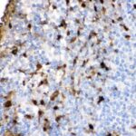 ANTICORPO ANTI-S100A9 POLICLONAL IGG COELHO - 100UG