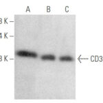 ANTICORPO CD3-E (UCH-T1)