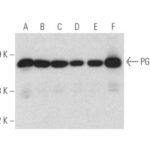 ANTICORPO PGK1 (14)