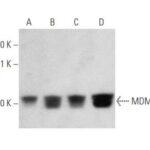MDM2 ANTIBODY (D-7) CAMUNDONGO MONO. IGG2B - 10UG