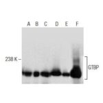 ANTICORPO GTBP (E-8)
