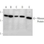 ANTICORPO RIBOSOMAL PROTEIN LP0 (1B4)