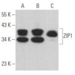 ZIP1 ANTICORPO (F-2)