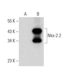 ANTICORPO NKX-2.2 (D-4) HRP