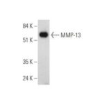 ANTICORPO MMP-13 (C3)