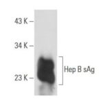 ANTICORPO HEP B SAG (1023) CAMUNDONGO MONOCLONAL IGG1 - 200UG/ML