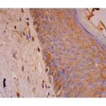 ANTICORPO DSG1 (27B2)