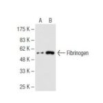 ANTICORPO FIBRINOGEN (5C5)  IGG1 - FR/100UL