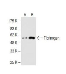ANTICORPO FIBRINOGEN (5C5)  IGG1 - FR/100UL