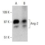 ANTICORPO ANG-2 (F-1)