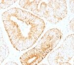 M00102