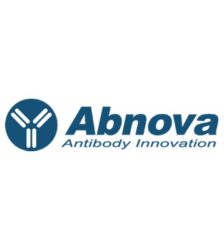 Anticorpos - Abnova