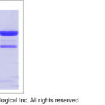PROTEÍNA RECOMBINANTE DECTIN-1, HUMANA, MARCADOR MFC - 200UG/ML