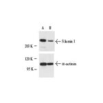 PLASMIDEO FILAMIN 1 SHRNA (H) - FR/20UG