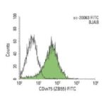 IGM CAMUNDONGO NORMAL - 100 TESTES - 2ML
