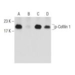 COQUETEL INIBIDOR DE FOSFATASE A - FR/1ML