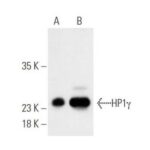 PROTEINA A-AGAROSE, 100 REACOES - FR/2ML
