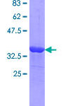 PROTEINA RECOMBINATE OVGP1 (HUMANA) (Q01) - FR/10UG